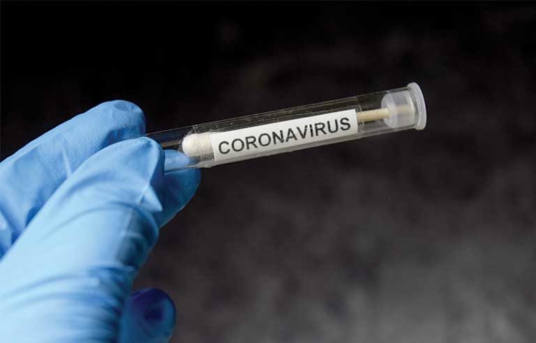 coronavirus-test