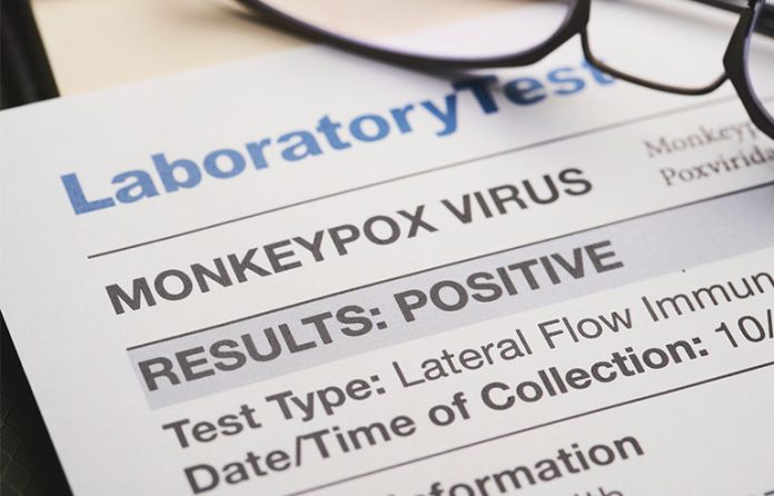 Monkeypox