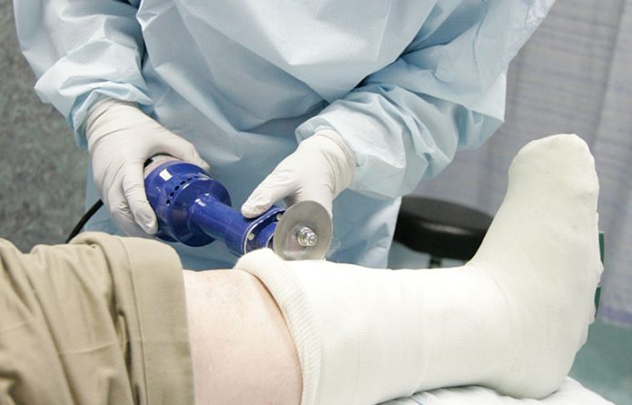 nurse removing cast
