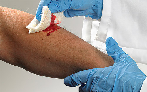 cut arm