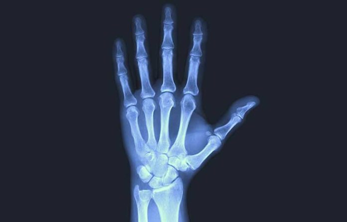 xray of hand
